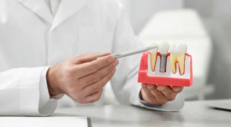 Common Misconceptions and Truths About Dental Implants: Unveiling the Mysteries of Oral Health