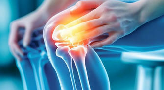 Arthritis: Understanding, Managing, and Treating the Condition